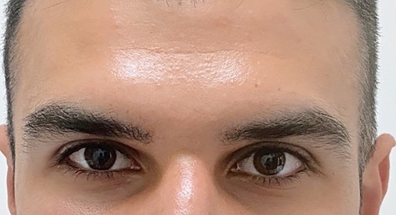 Close-up of a person's face and eyes.