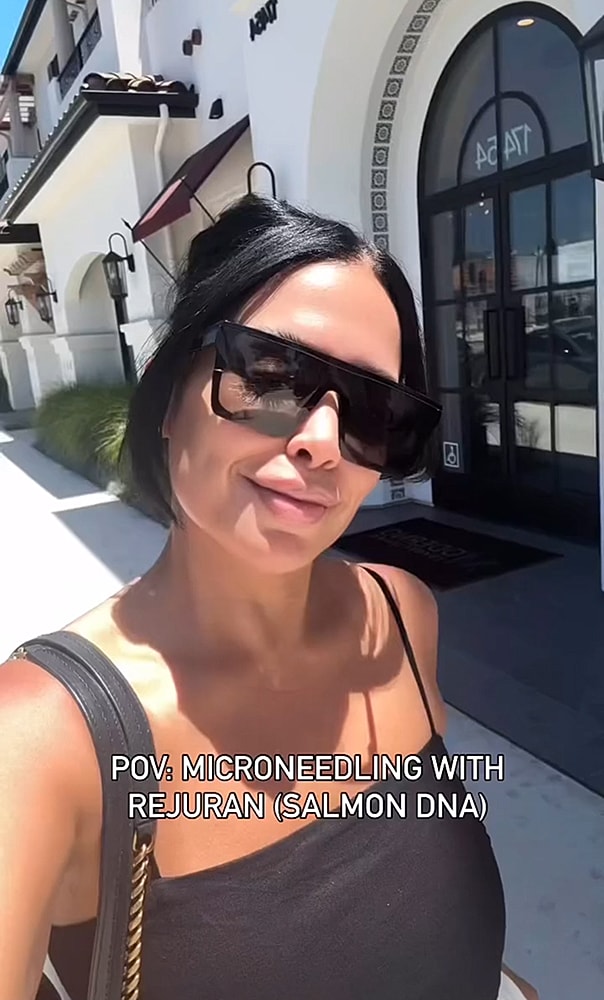 Woman with sunglasses, microneedling treatment outdoors.
