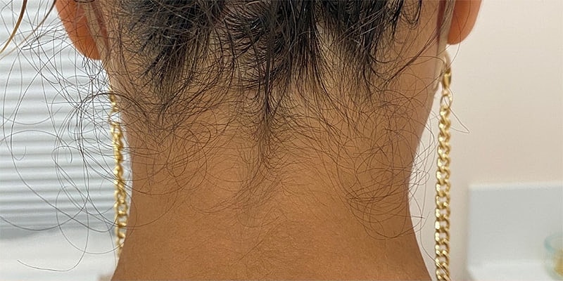Back of a head with short, curly hair.